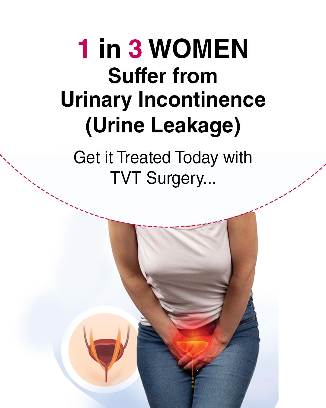 Urinary Incontinence
